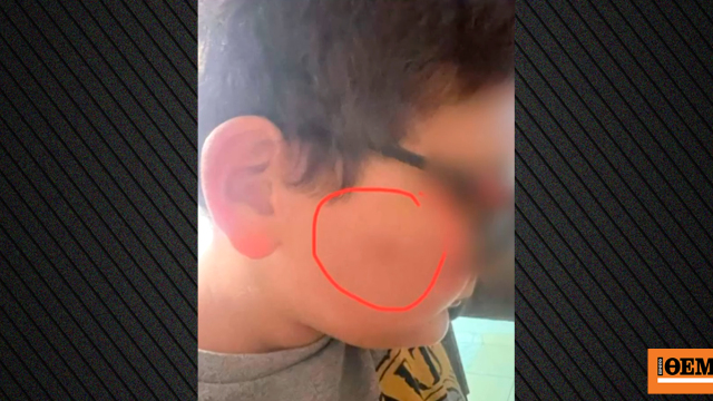 Συγκλονίζει η μητέρα του 11χρονου που ξυλοκοπήθηκε στο διάλειμμα από συμμαθητές του