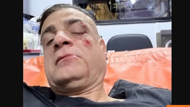 Άγριος ξυλοδαρμός Youtuber σε σταθμό του μετρό από πορτοφολάδες