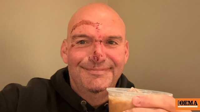 Ο γερουσιαστής Τζον Φέτερμαν δημοσίευσε φωτογραφία με ράμματα στο πρόσωπο μετά την πτώση του στο Πίτσμπουργκ