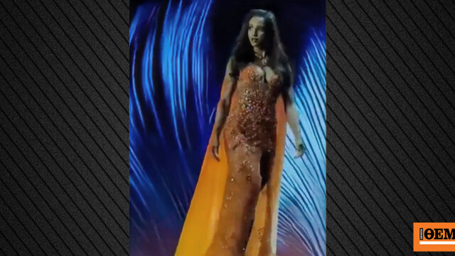 Με εγκεφαλική αιμορραγία νοσηλεύεται στην Εντατική η Μις Τζαμάικα μετά την πτώση της