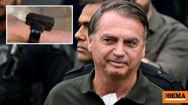 Ο Μπολσονάρο δήλωσε ότι προσπάθησε να ανοίξει το ηλεκτρονικό βραχιολάκι του από «περιέργεια»