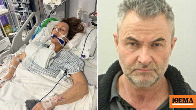 Παράλυτη για πάντα 57χρονη μετά τον άγριο ξυλοδαρμό από τον σύντροφό της στη Βρετανία – Της έσπασε το λαιμό όταν του είπε ότι θα τον αφήσει