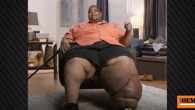 Η συγκλονιστική ιστορία άνδρα που ζύγιζε 270 κιλά και άλλαξε τη ζωή του μετά από πολύπλοκη επέμβαση