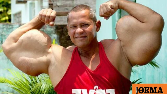 Βραζιλιάνος «Ποπάι» πέθανε στα 55 του, είχε γίνει διάσημος από τις ενέσεις με έλαια για να αποκτήσει μεγάλα μπράτσα