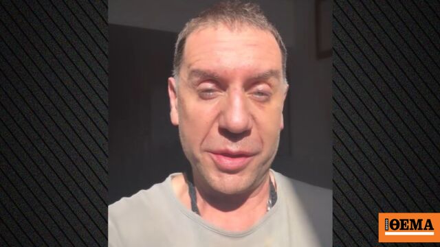 Γιώργος Μαζωνάκης: Μην ξανακούσω κανέναν να λέει ότι δεν θα γίνει η συναυλία μου λόγω του ματιού μου, θα του κόψω το κεφάλι