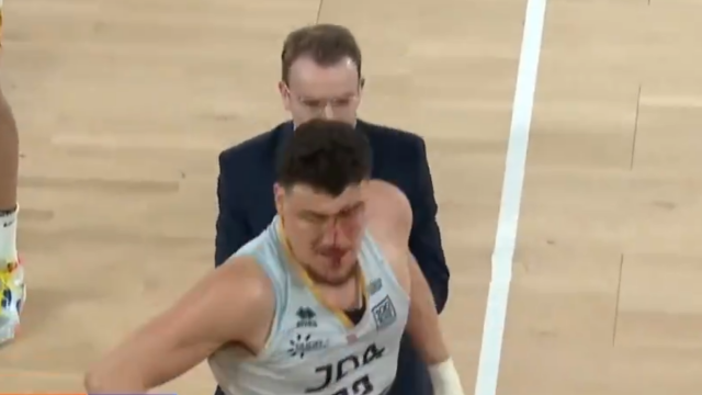 Σε αγώνα μποξ μετατράπηκε το ματς της Μονακό με την Ντιζόν: Μάτωσε παίκτης των φιλοξενούμενων, δείτε βίντεο