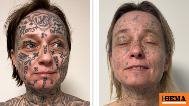 Απίστευτη κακοποίηση στην Ολλανδία: Έκανε τατουάζ 250 φορές το όνομά του στο κορμί της κοπέλας του!