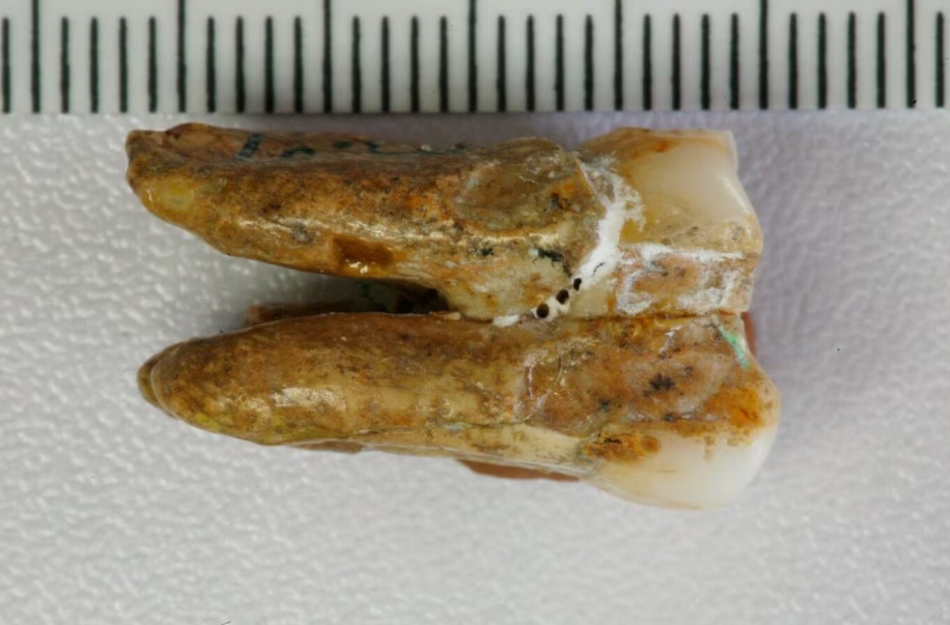Neandertalët kishin “dentist” 59 mijë vjet më parë/ Zbulimi në një shpellë në Rusi Neandertalët kishin “dentist” 59 mijë vjet më parë/ Zbulimi në një shpellë në Rusi